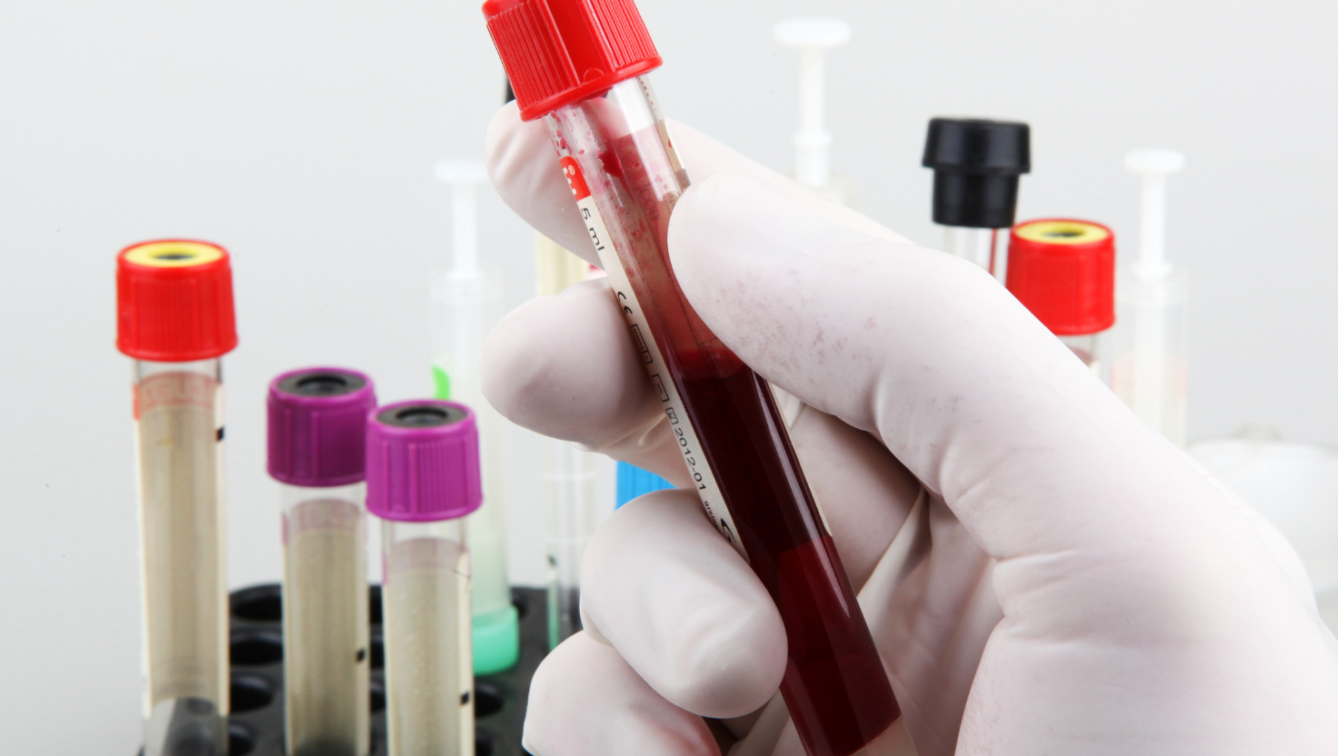 Erros Diagnósticos e Laboratoriais: O Impacto de Resultados Incorretos na Conduta Médica