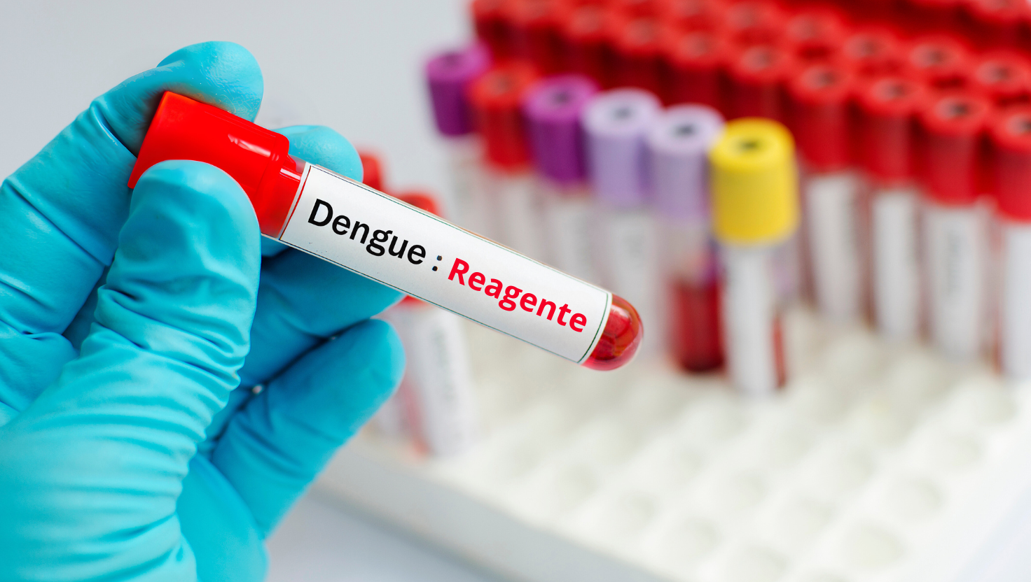 Por que os exames para dengue não seguem mais um padrão clássico de diagnóstico?