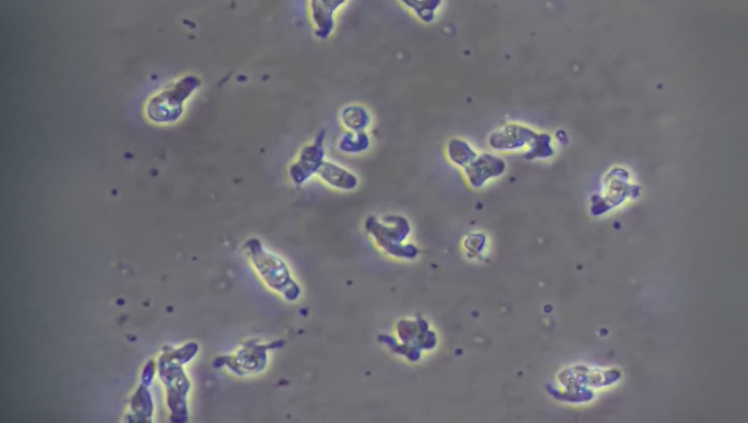 Naegleria fowleri: A Ameba Letal que Causa Infecção Cerebral Fulminante