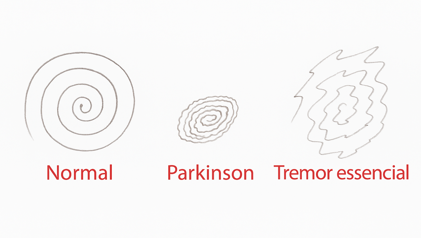 Teste da Espiral: Como um Simples Desenho Pode Ajudar no Diagnóstico de Parkinson