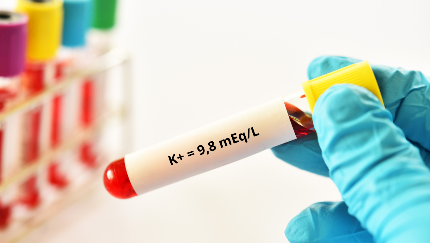 O Potássio na Hipercalemia