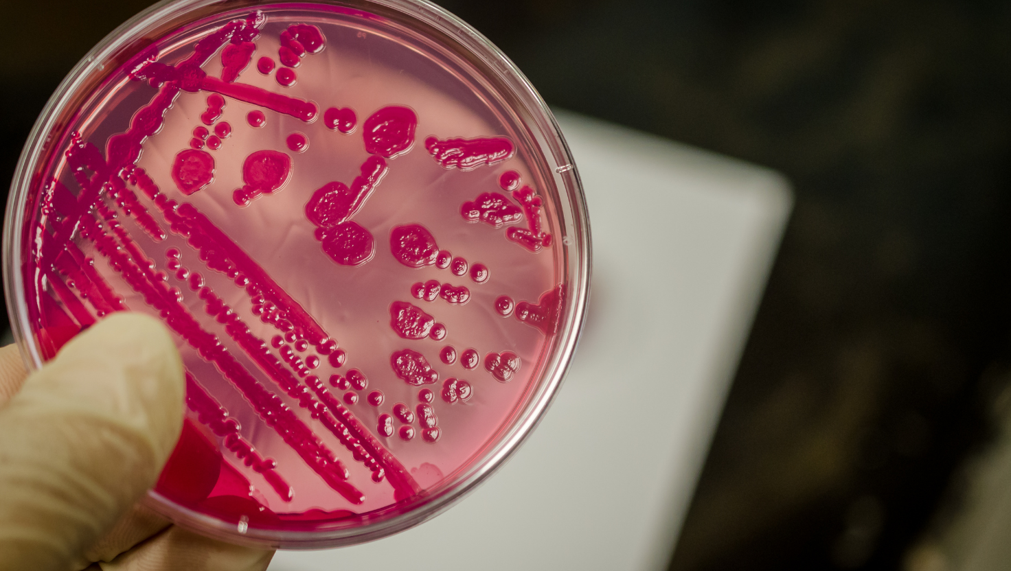 Salmonela e Shigella: Diferenças, Sintomas e Como Prevenir Infecções Bacterianas