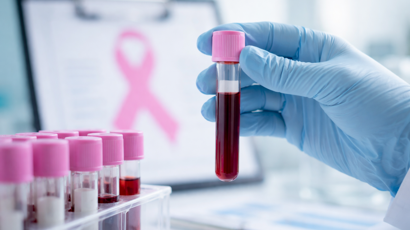 Exame de sangue para detectar câncer de mama começa a ser testado no Brasil